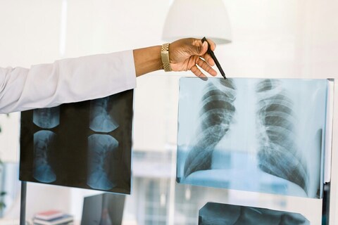 Doctor looking at x-ray scans
